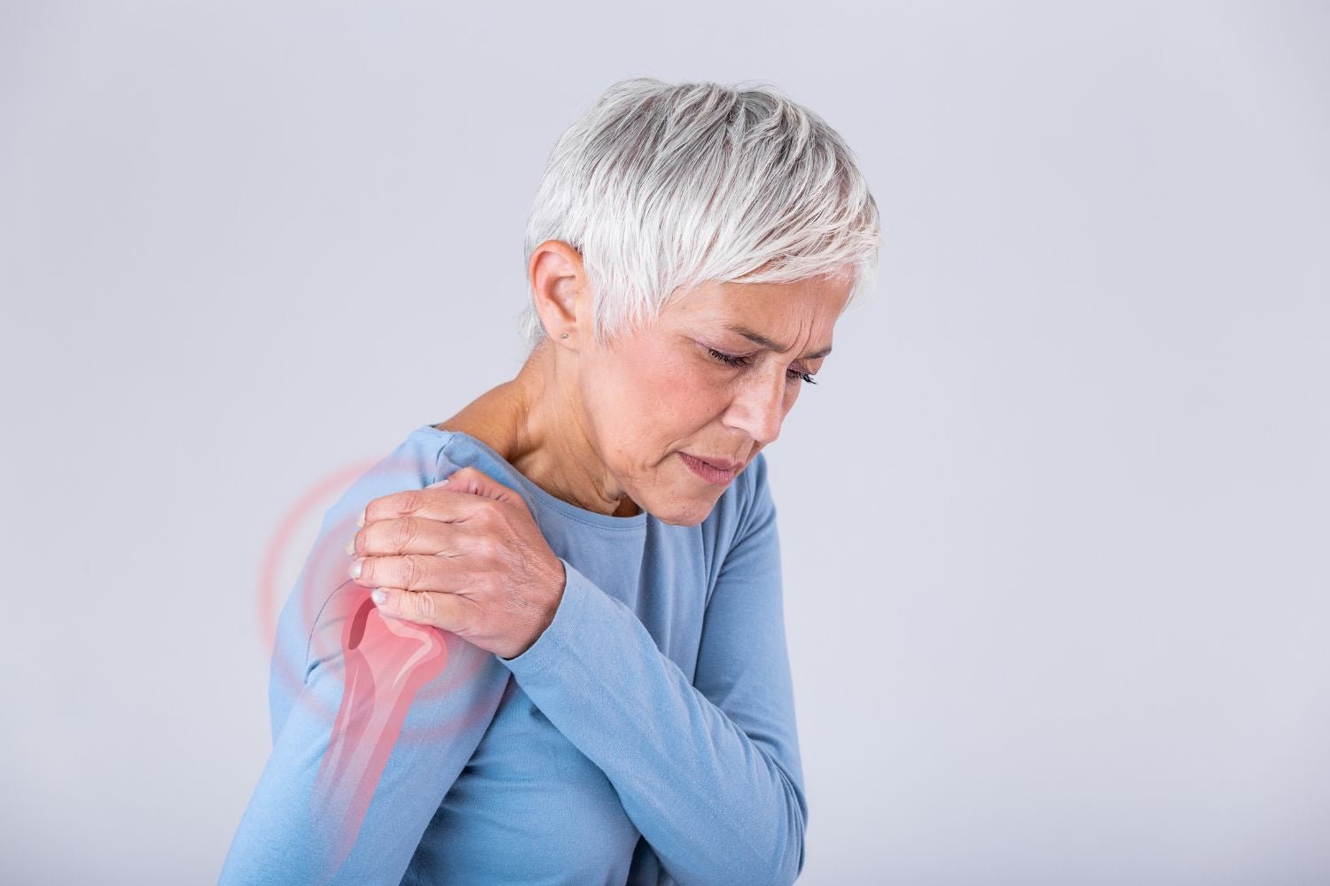 Déchirure musculaire de l'épaule : durée et traitements - Cellsius | L’Orthopédie au service de votre bien-être