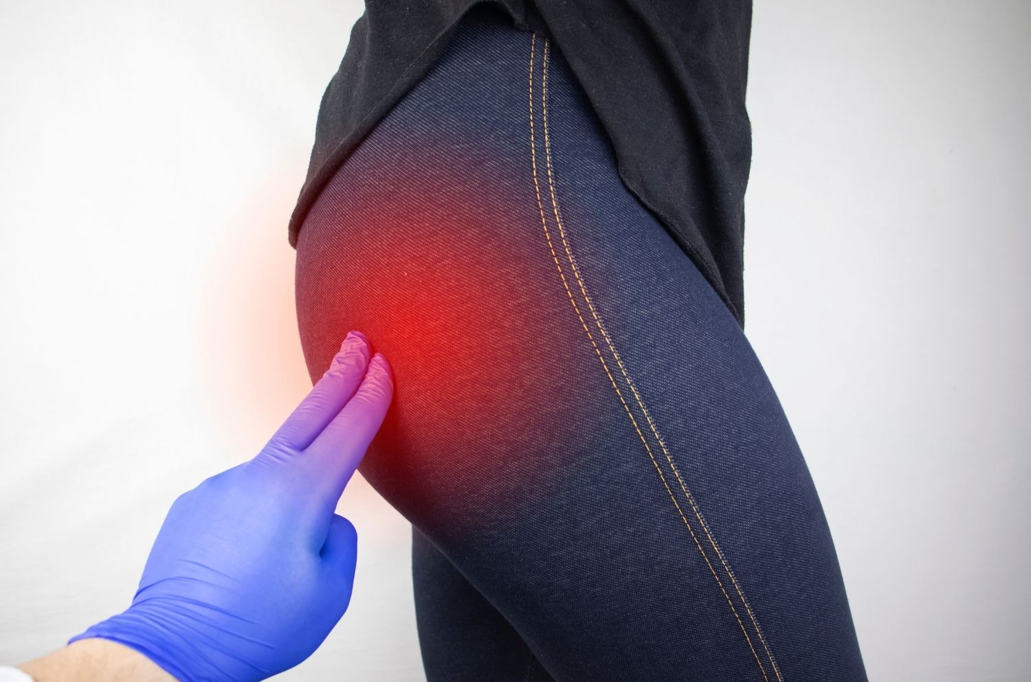 Mal au Fessier en Position Assise : Causes & solutions efficaces - Cellsius | L’Orthopédie au service de votre bien-être