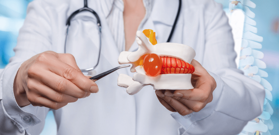 Bien comprendre l'opération de hernie discale - Cellsius | L’Orthopédie au service de votre bien-être