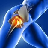 Douleurs au Coccyx