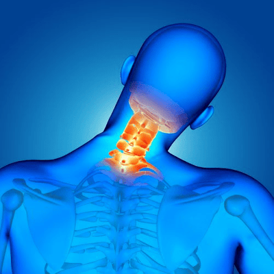 Douleurs aux Cervicales