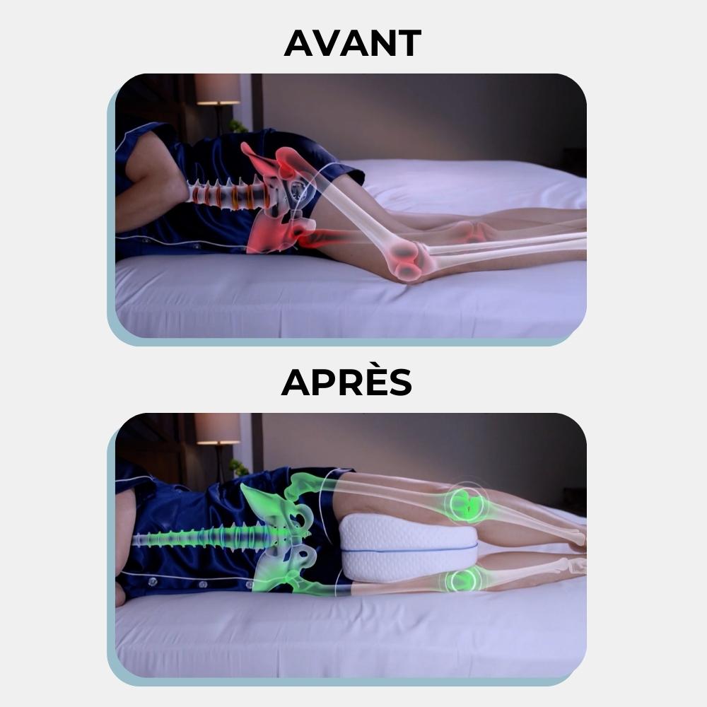 avant après coussin genou