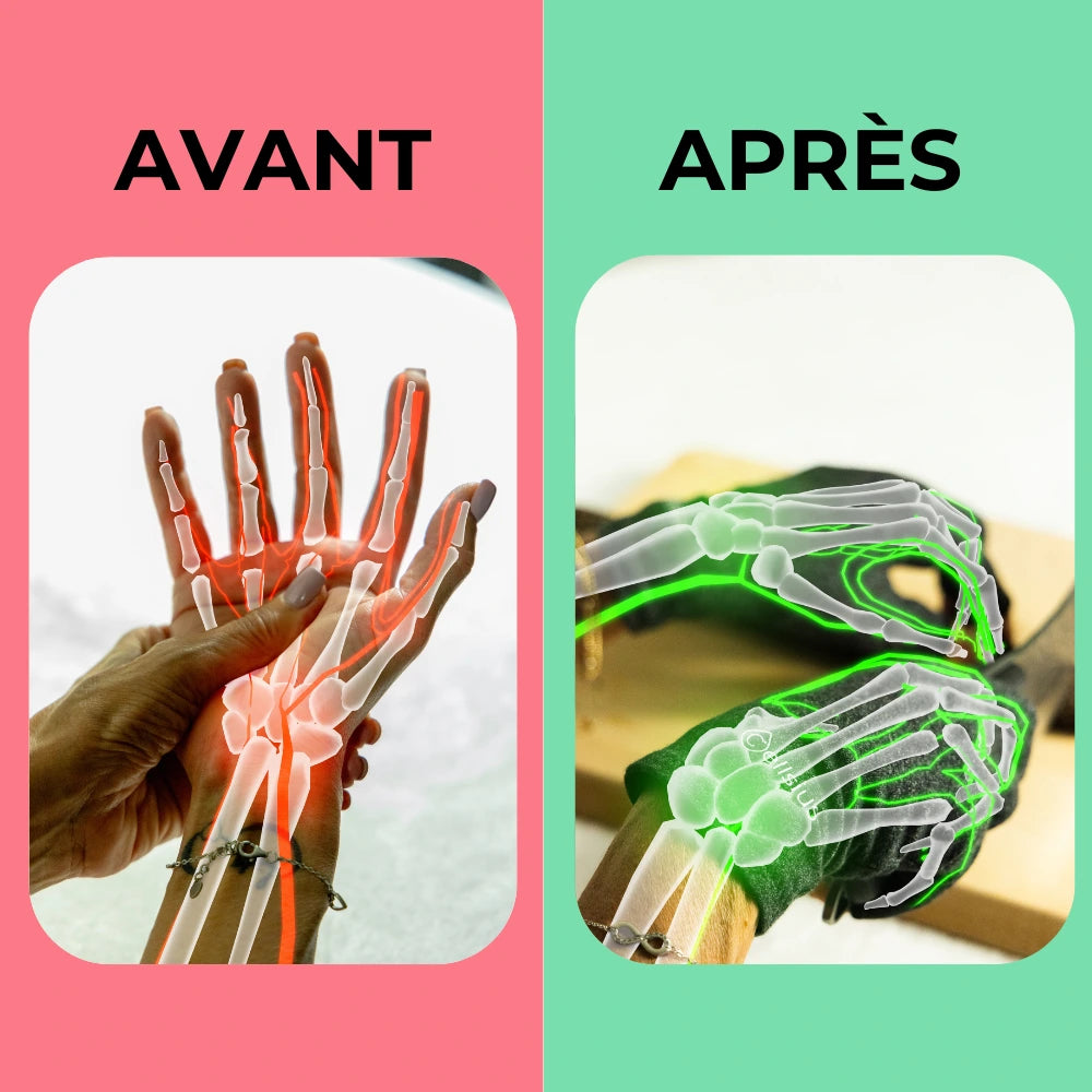 Gants de Mobilité Cellsius - Libérez vos mains de la douleur