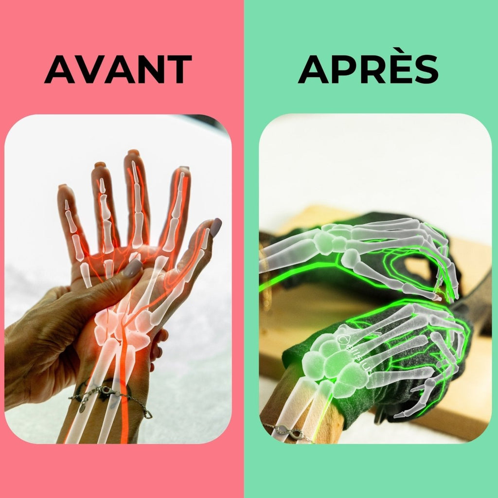 Gants de Mobilité Cellsius - Libérez vos mains de la douleur - Cellsius | L’Orthopédie au service de votre bien - être